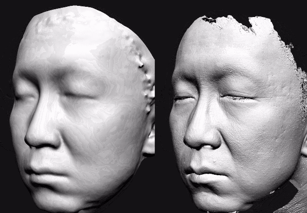 美际3D皮肤分析仪P2发布，引领行业新风潮-第4张图片