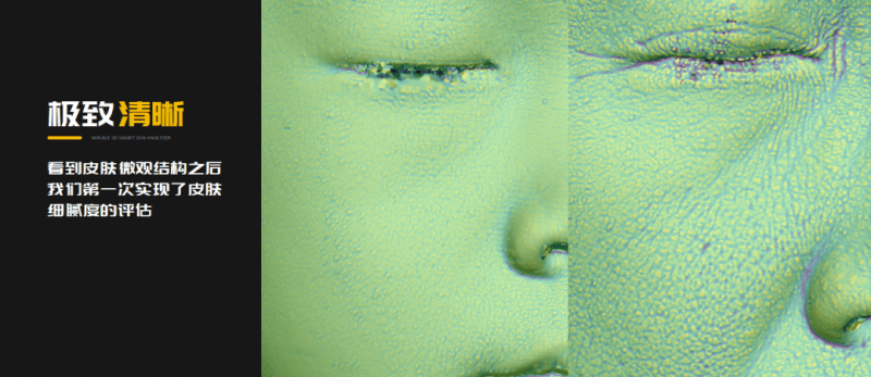 美际3D皮肤分析仪P2发布，引领行业新风潮-第5张图片