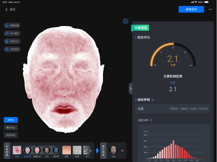 美际3D皮肤分析仪P2发布，引领行业新风潮-第10张图片