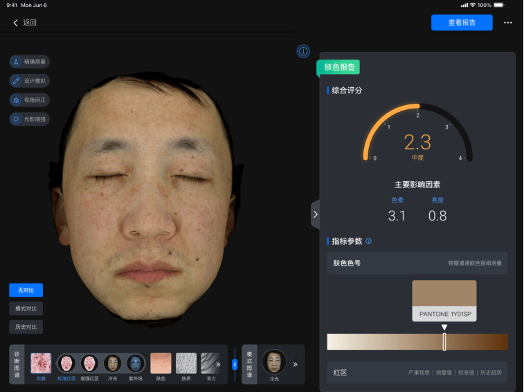 美际3D皮肤分析仪P2发布，引领行业新风潮-第11张图片