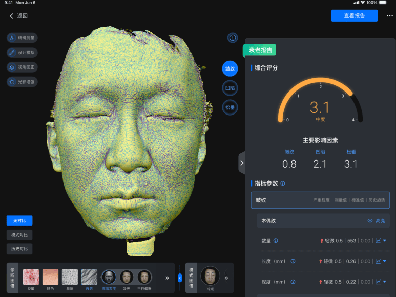 美际3D皮肤分析仪P2发布，引领行业新风潮-第13张图片